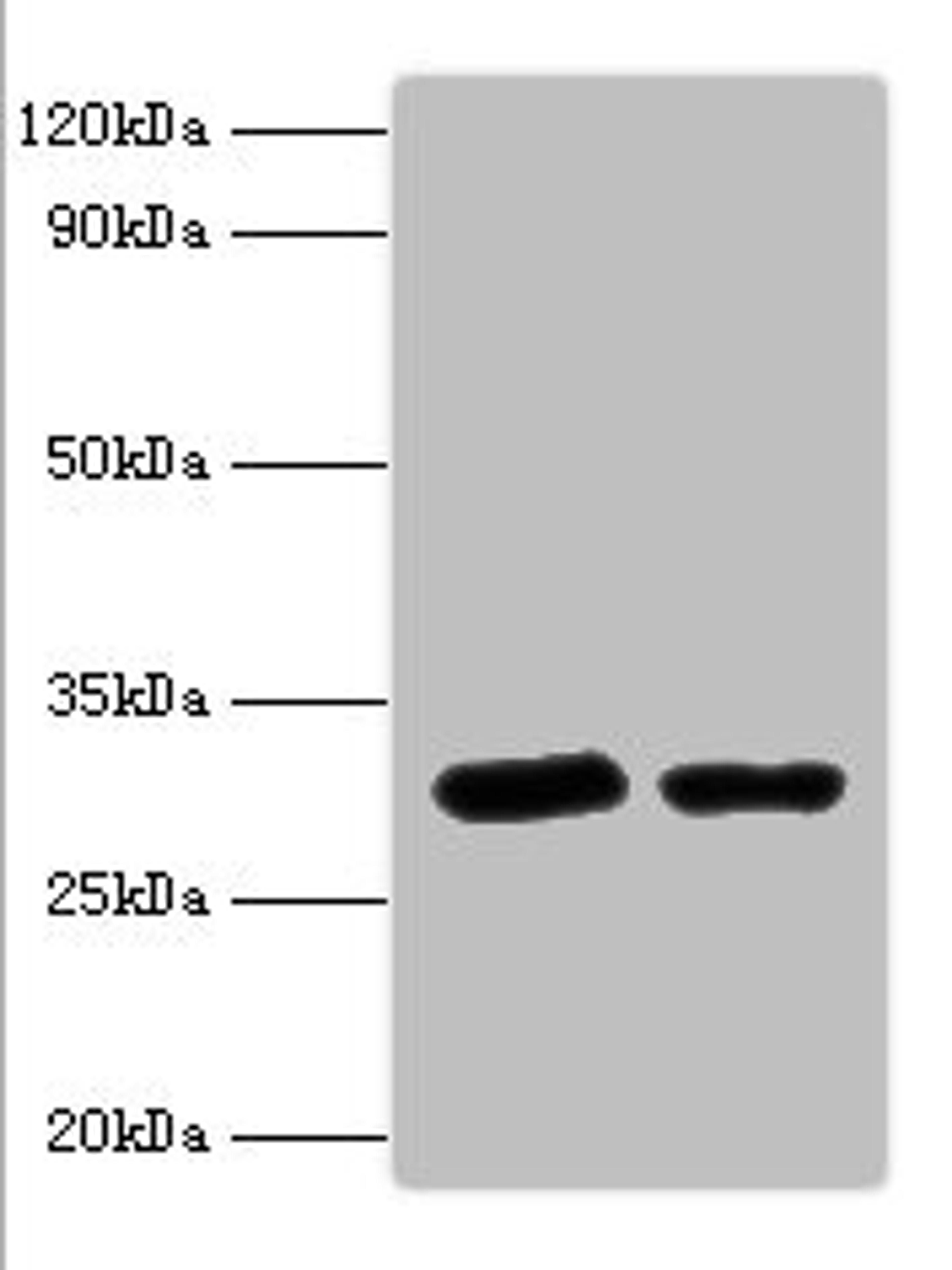 Western blot. All lanes: Syntaxin-6 antibody at 2ug/ml. Lane 1: Mouse brain tissue. Lane 2: 293T whole cell lysaye. Secondary. Goat polyclonal to rabbit IgG at 1/10000 dilution. Predicted band size: 29 kDa. Observed band size: 29 kDa. 