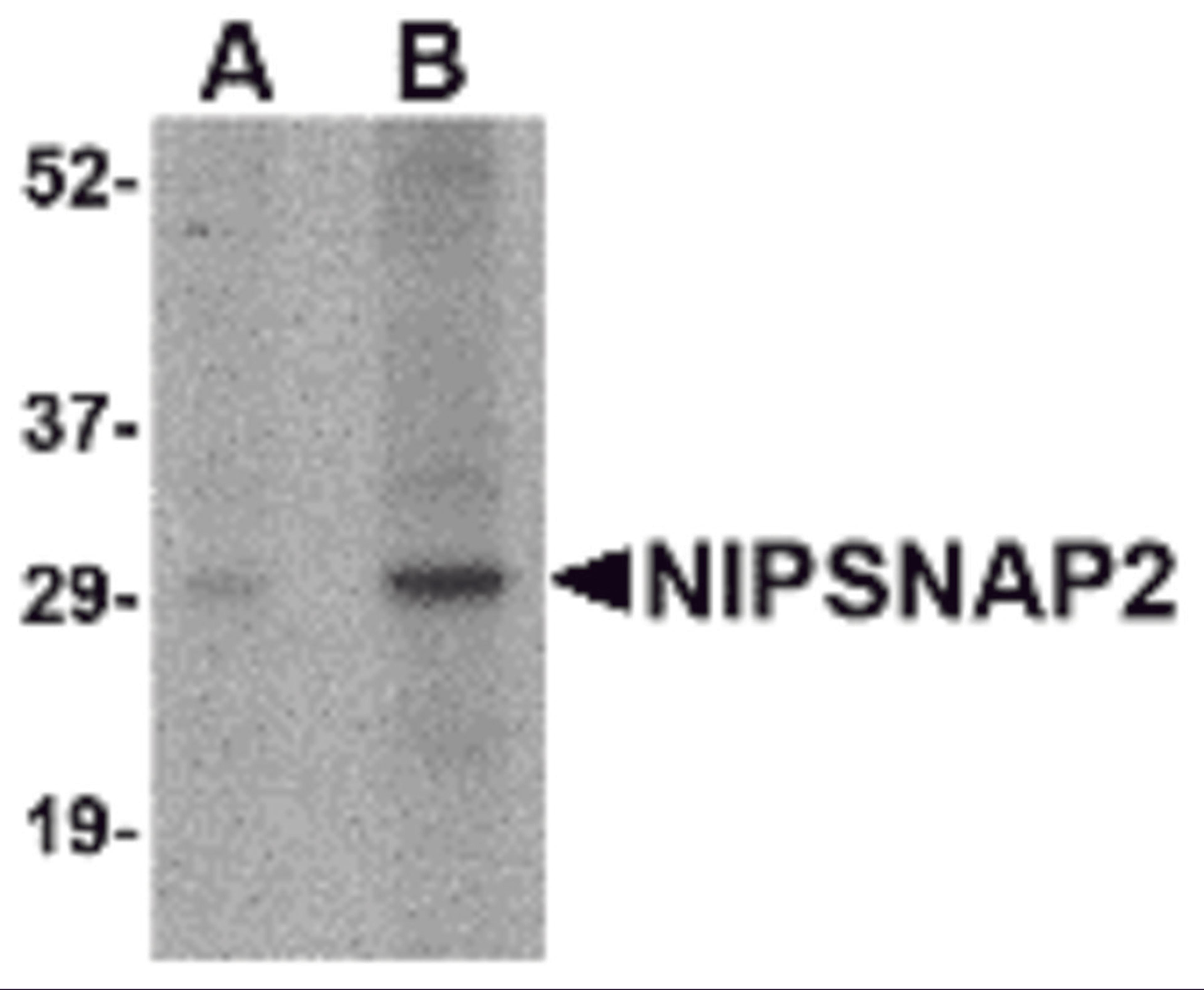 Western blot analysis of NIPSNAP2 in human skeletal muscle tissue lysate with NIPSNAP2 antibody at (A) 1 and (B) 2 &#956;g/mL.