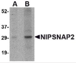 Western blot analysis of NIPSNAP2 in human skeletal muscle tissue lysate with NIPSNAP2 antibody at (A) 1 and (B) 2 μg/mL.