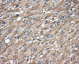 Immunohistochemistry-Paraffin: CAPZA1 Antibody (2G4) [NBP2-02500] - Staining of paraffin-embedded liver tissue using anti-CAPZA1 mouse monoclonal antibody.