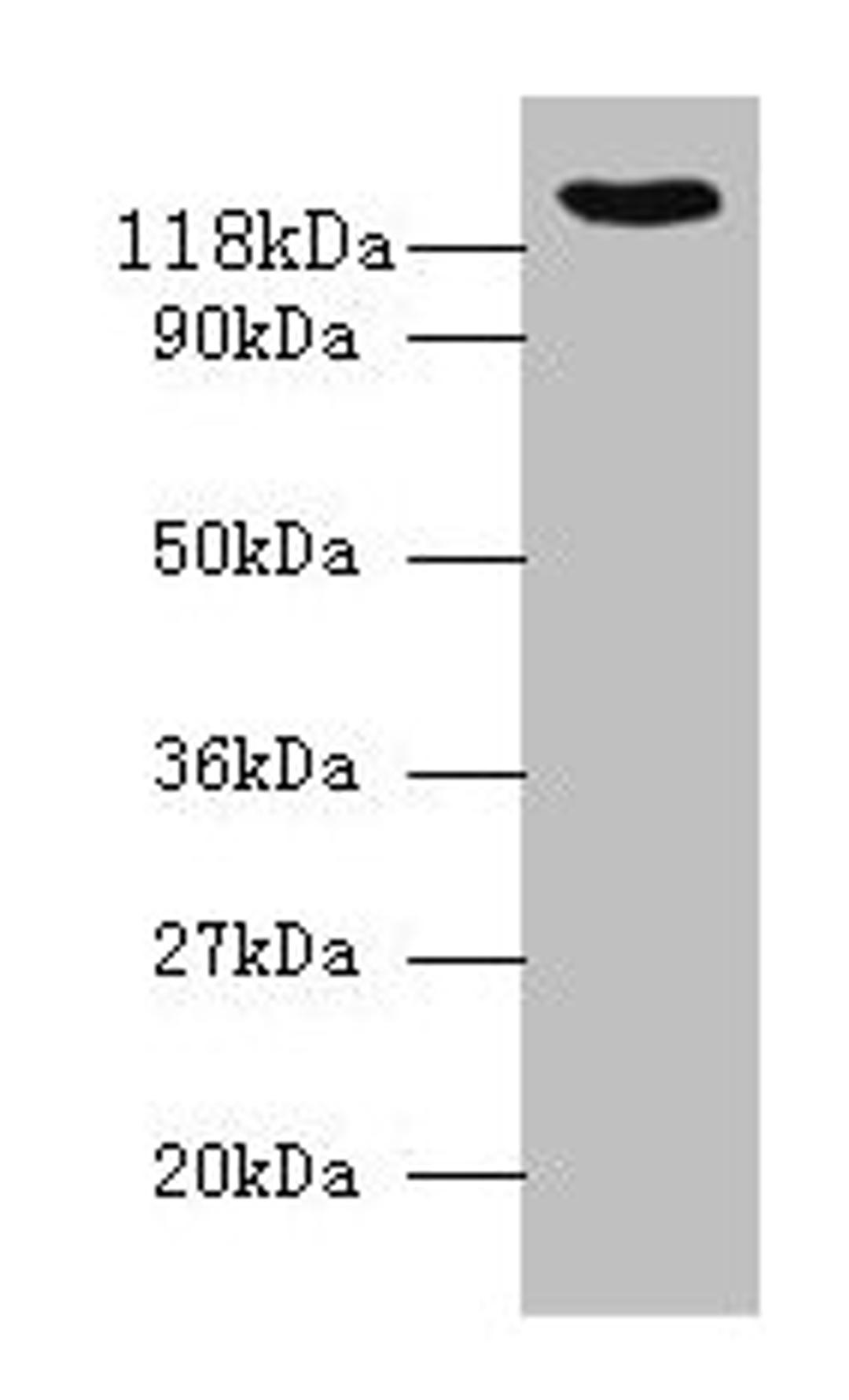 Western blot. All lanes: VCL antibody at 2µg/ml + 293T whole cell lysate. Secondary. Goat polyclonal to rabbit IgG at 1/10000 dilution. Predicted band size: 124, 117, 25 kDa. Observed band size: 124 kDa
