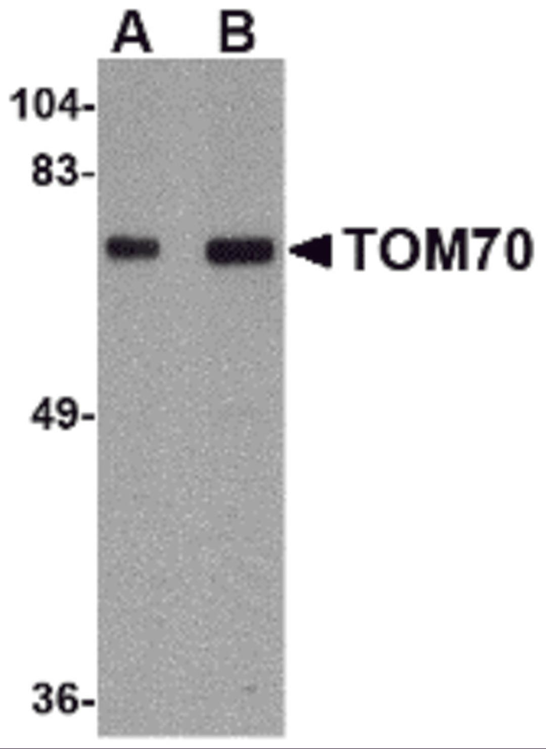 Western blot analysis of TOM70 in rat brain tissue lysate with TOM70 antibody at (A) 1 and (B) 2 &#956;g/mL.