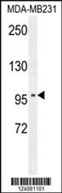 Western blot analysis in MDA-MB231 cell line lysates (35ug/lane).