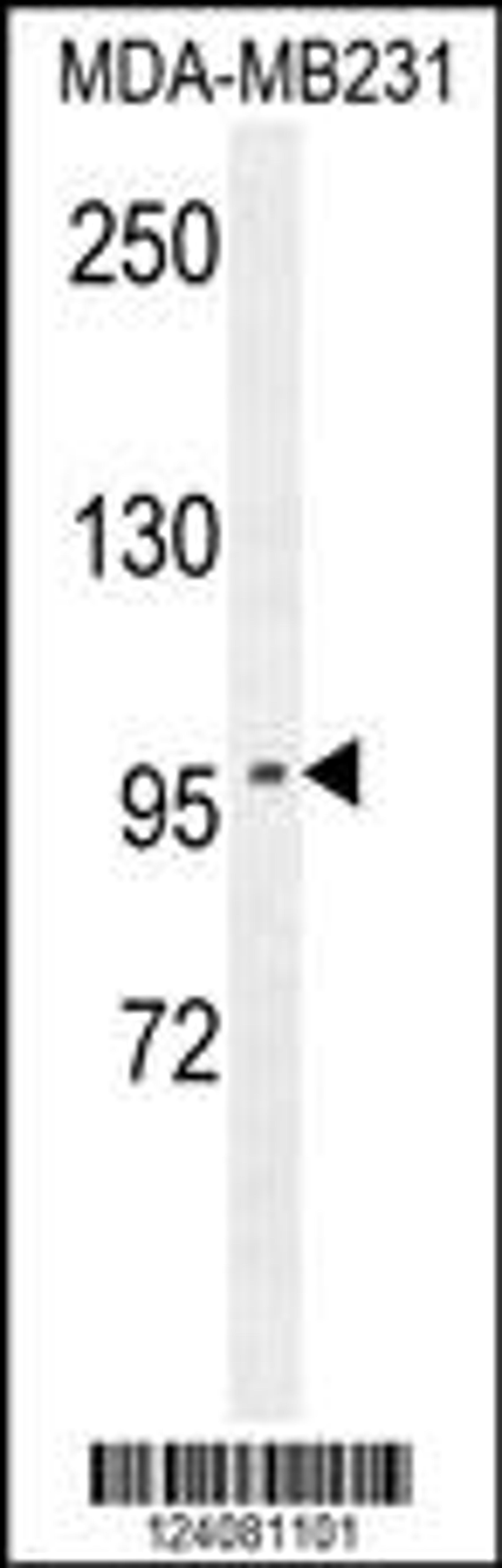 Western blot analysis in MDA-MB231 cell line lysates (35ug/lane).