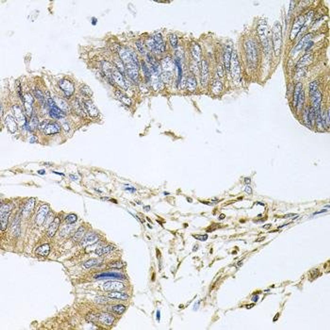 Immunohistochemical staining of mouse lung tissue using STRN3 antibody (dilution of 1:100)