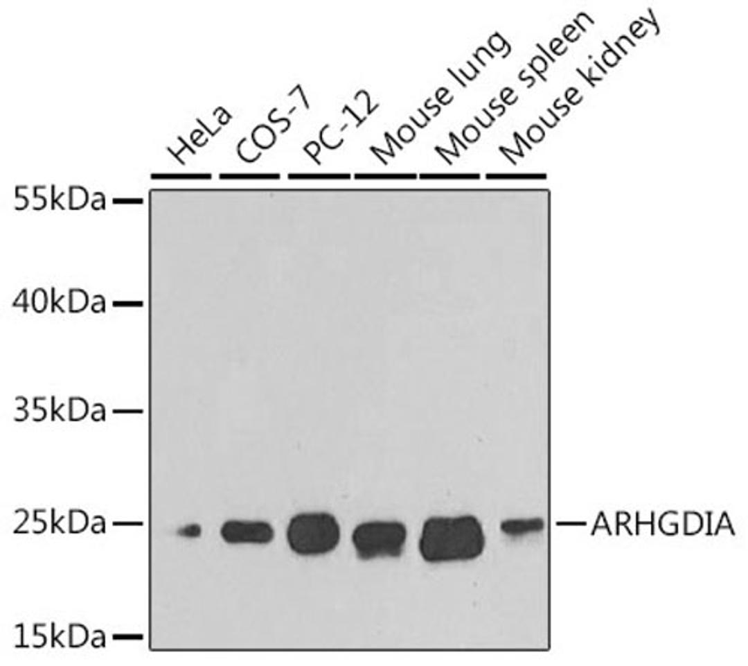 Western blot - ARHGDIA antibody (A1214)