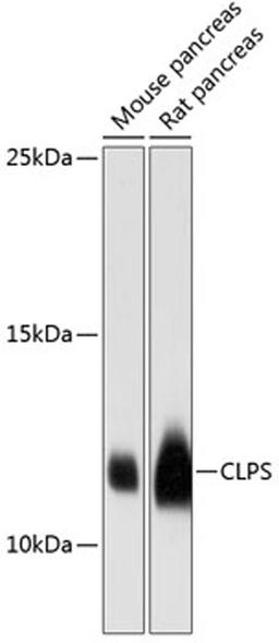 Western blot - CLPS antibody (A12772)