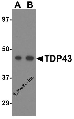 Western blot analysis of TDP43 in L1210 cell lysate with TDP43 antibody at (A) 0.5 and (B) 1 &#956;g/mL.