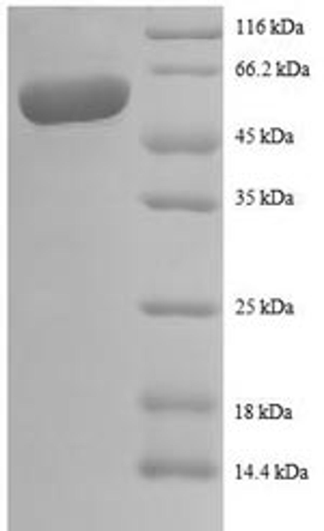 (Tris-Glycine gel) Discontinuous SDS-PAGE (reduced) with 5% enrichment gel and 15% separation gel.