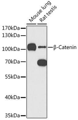 Western blot - ß-Catenin antibody (A11343)