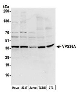 Detection of human and mouse VPS26A by western blot.