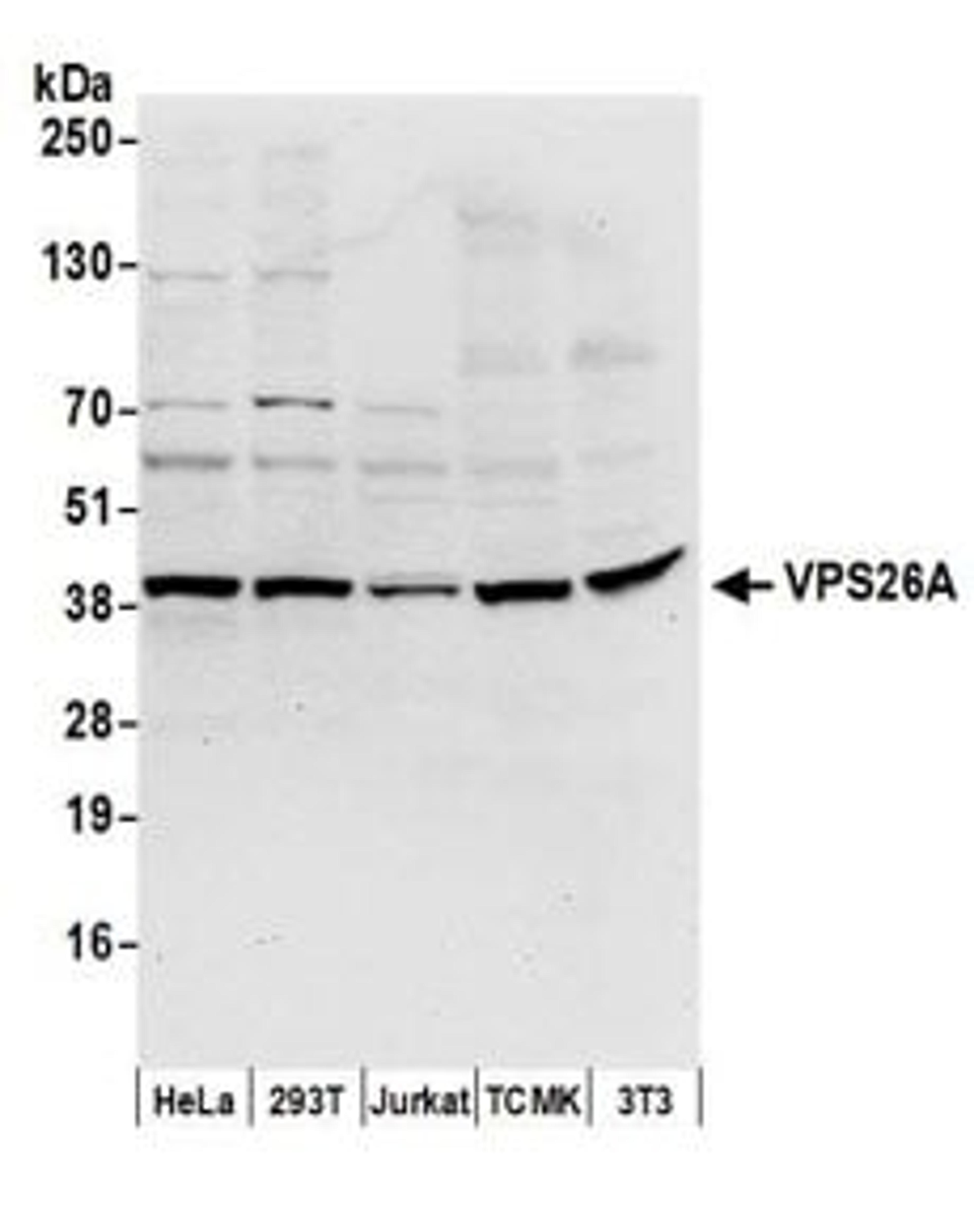 Detection of human and mouse VPS26A by western blot.