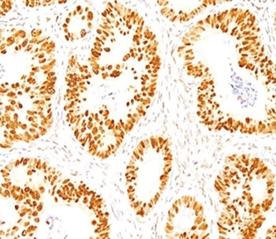 IHC staining of normal colon with p53 antibody (DO-7).