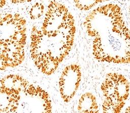 IHC staining of normal colon with p53 antibody (DO-7).