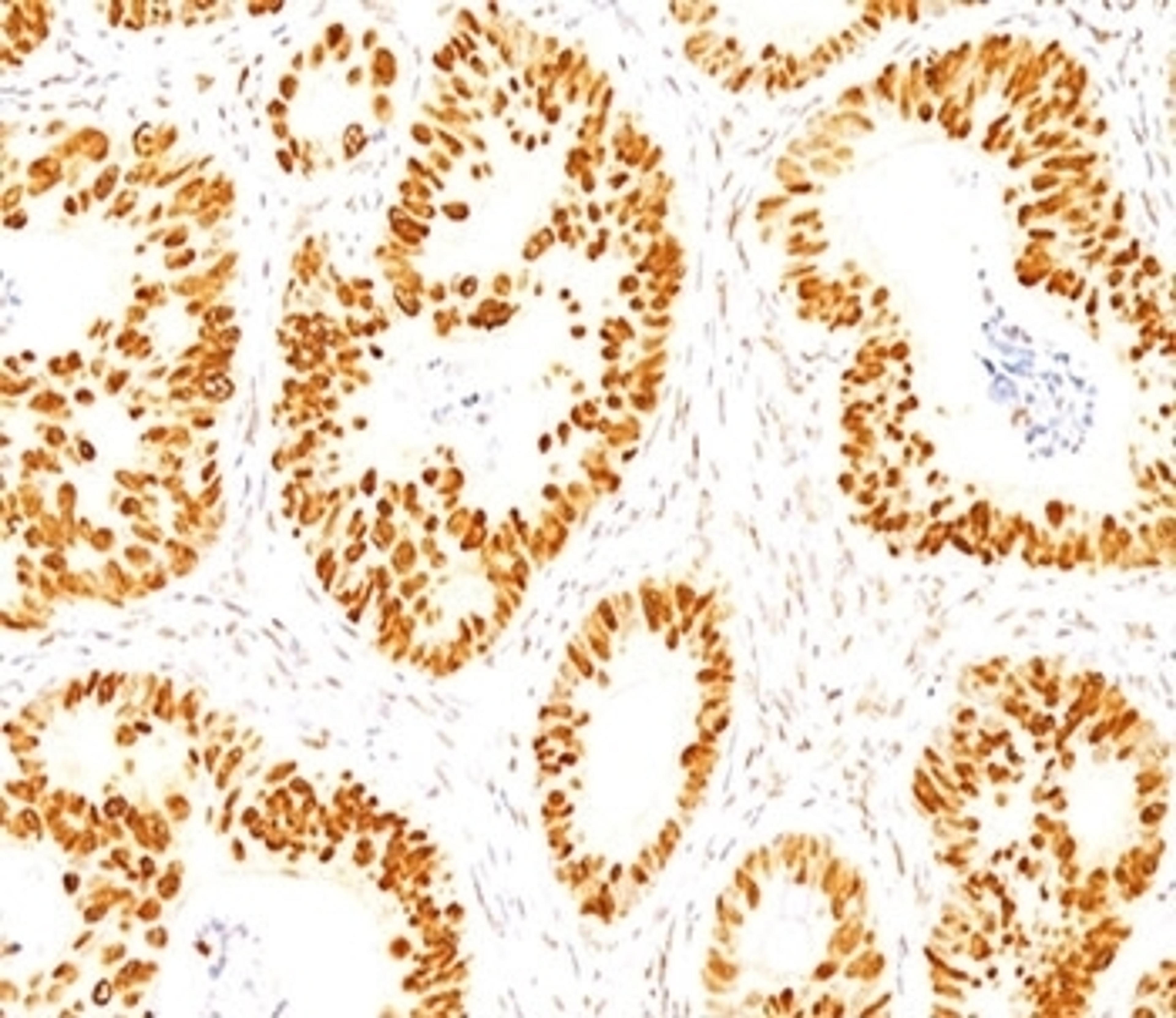 IHC staining of normal colon with p53 antibody (DO-7).