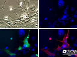 Immunocytochemistry/Immunofluorescence: GFP Antibody [NB600-310] - HEK 293 cells expressing GFP were visualized for GFP fluorescence (Green) or using NB600-310 to label the GFP (Red).  Nuclei (Blue) were counterstained using Hoechst 33258.