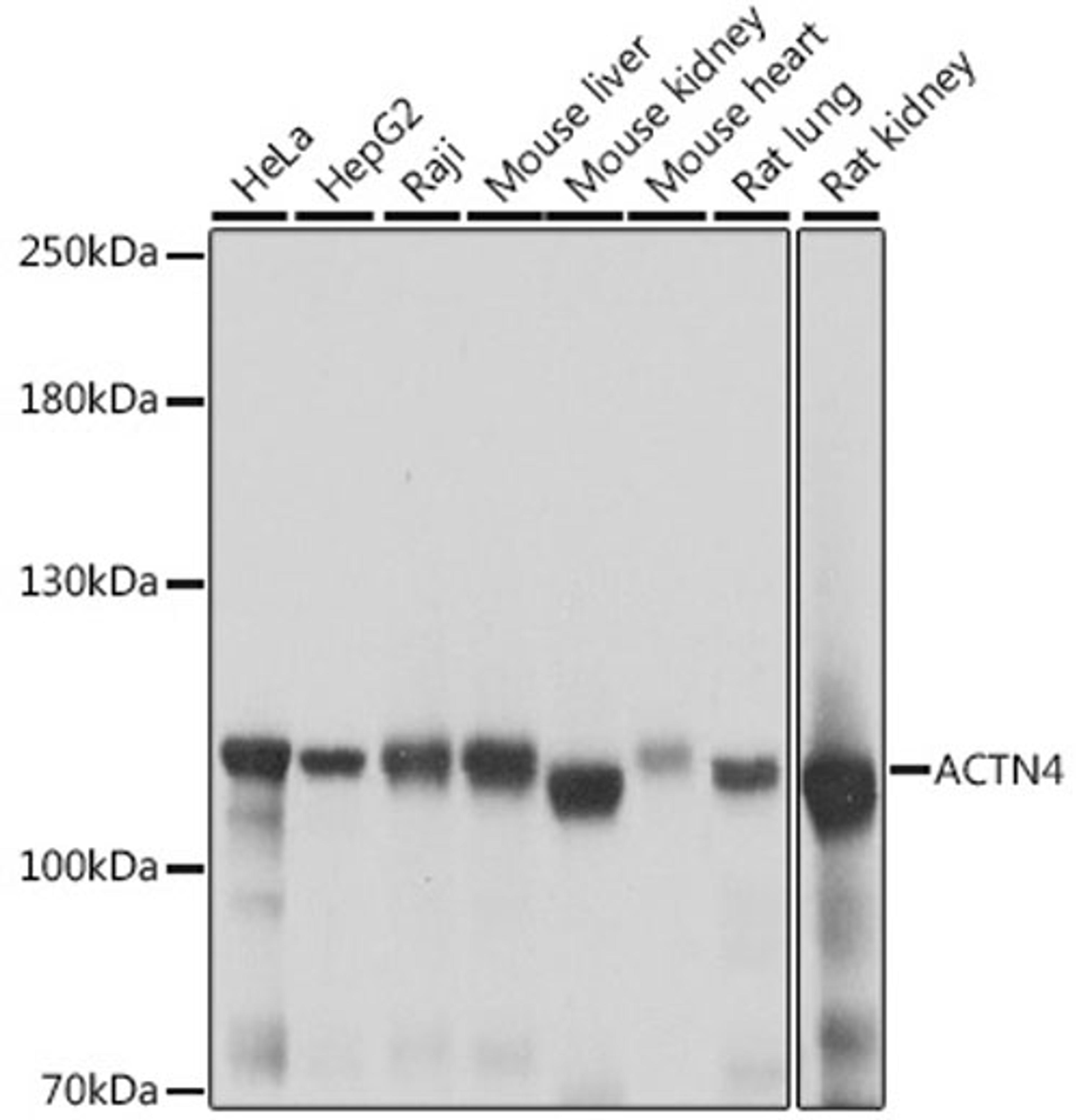 Western blot - ACTN4 antibody (A16310)