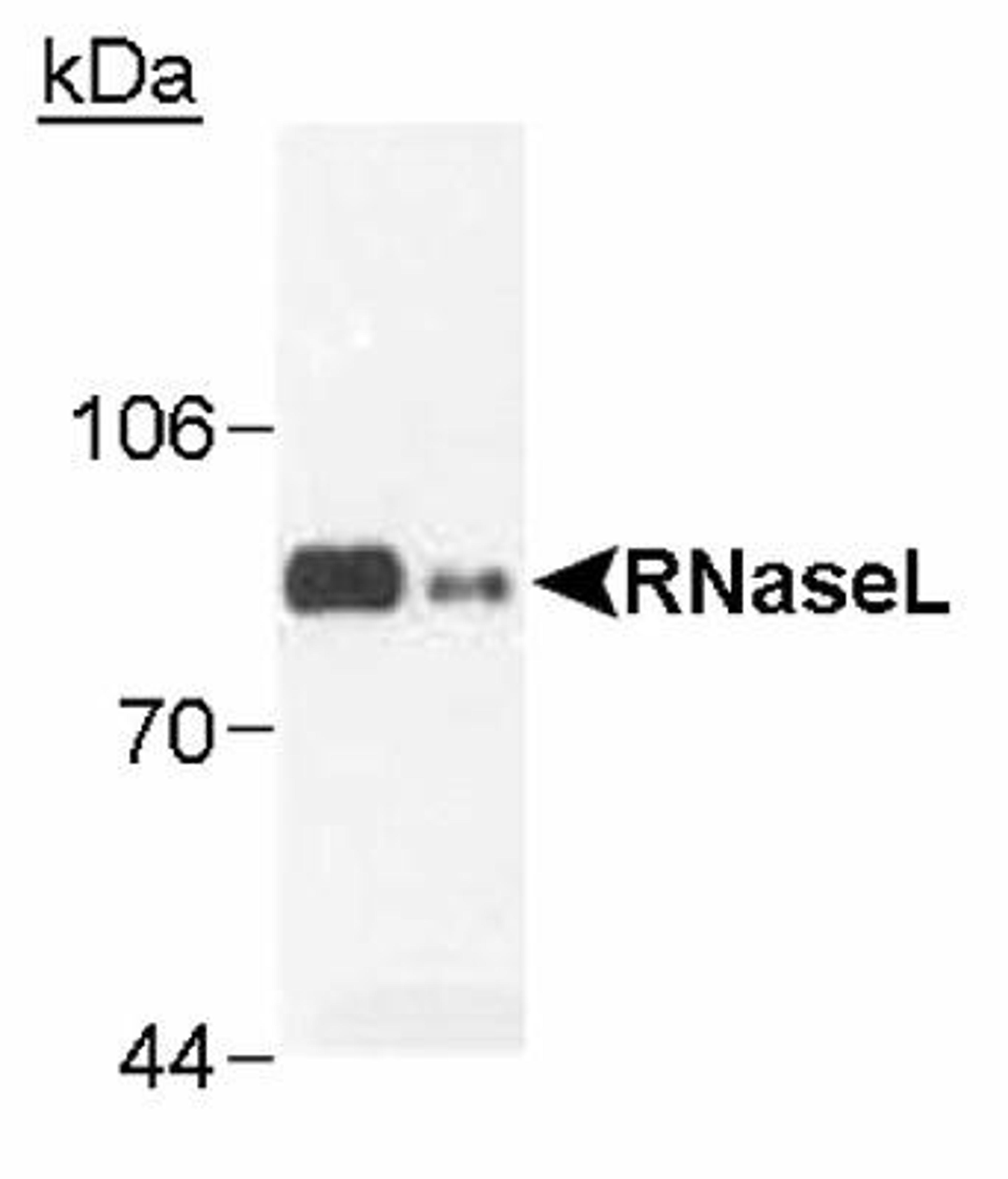 Western Blot: RNase L Antibody (2E9) [NB100-351] - RNaseL in transfected cells (0.1 ug) and Hey1B (100 ug)