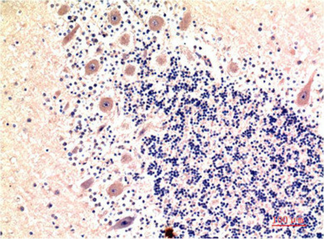 Immunohistochemical analysis of paraffin-embedded Human Brain Tissue using LC3B Mouse mAb diluted at 1:200.