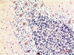 Immunohistochemical analysis of paraffin-embedded Human Brain Tissue using LC3B Mouse mAb diluted at 1:200.