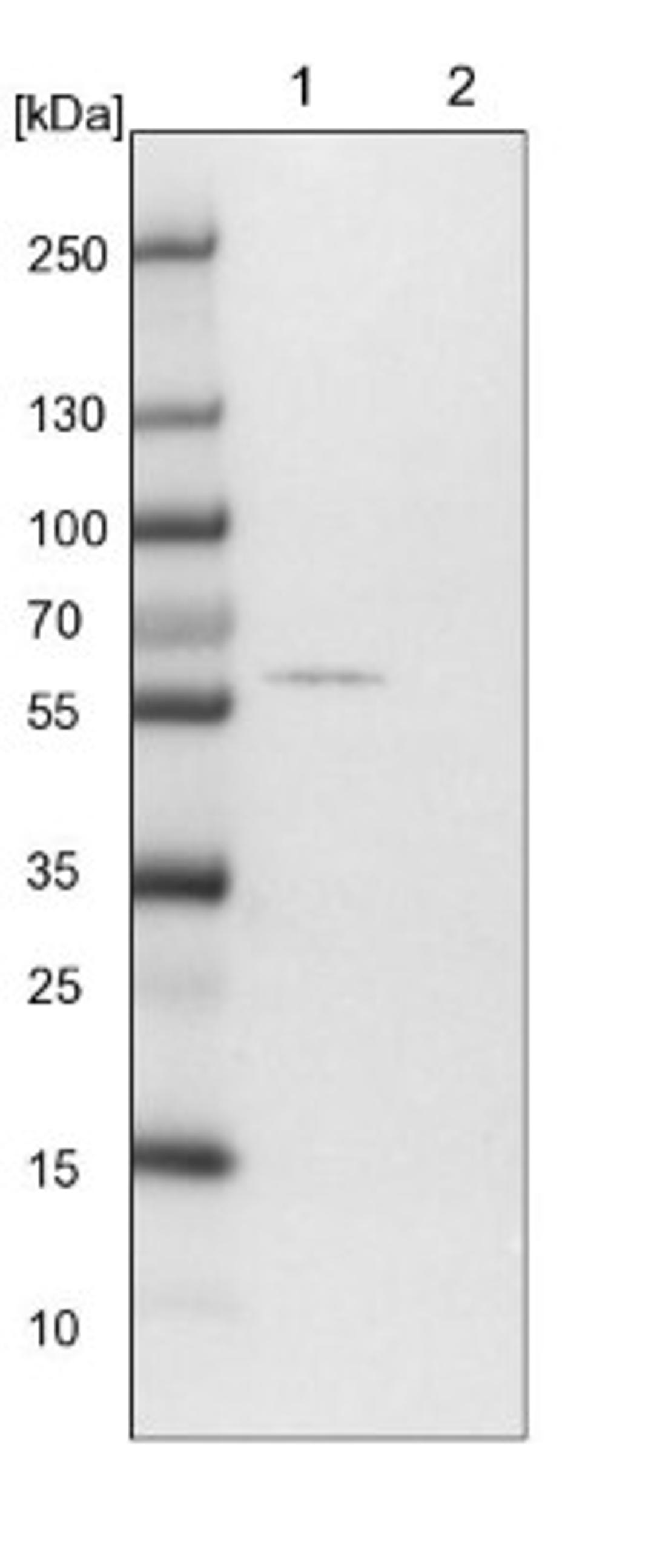 Western Blot: OTUD1 Antibody [NBP1-90484] - Lane 1: NIH-3T3 cell lysate (Mouse embryonic fibroblast cells)<br/>Lane 2: NBT-II cell lysate (Rat Wistar bladder tumour cells)