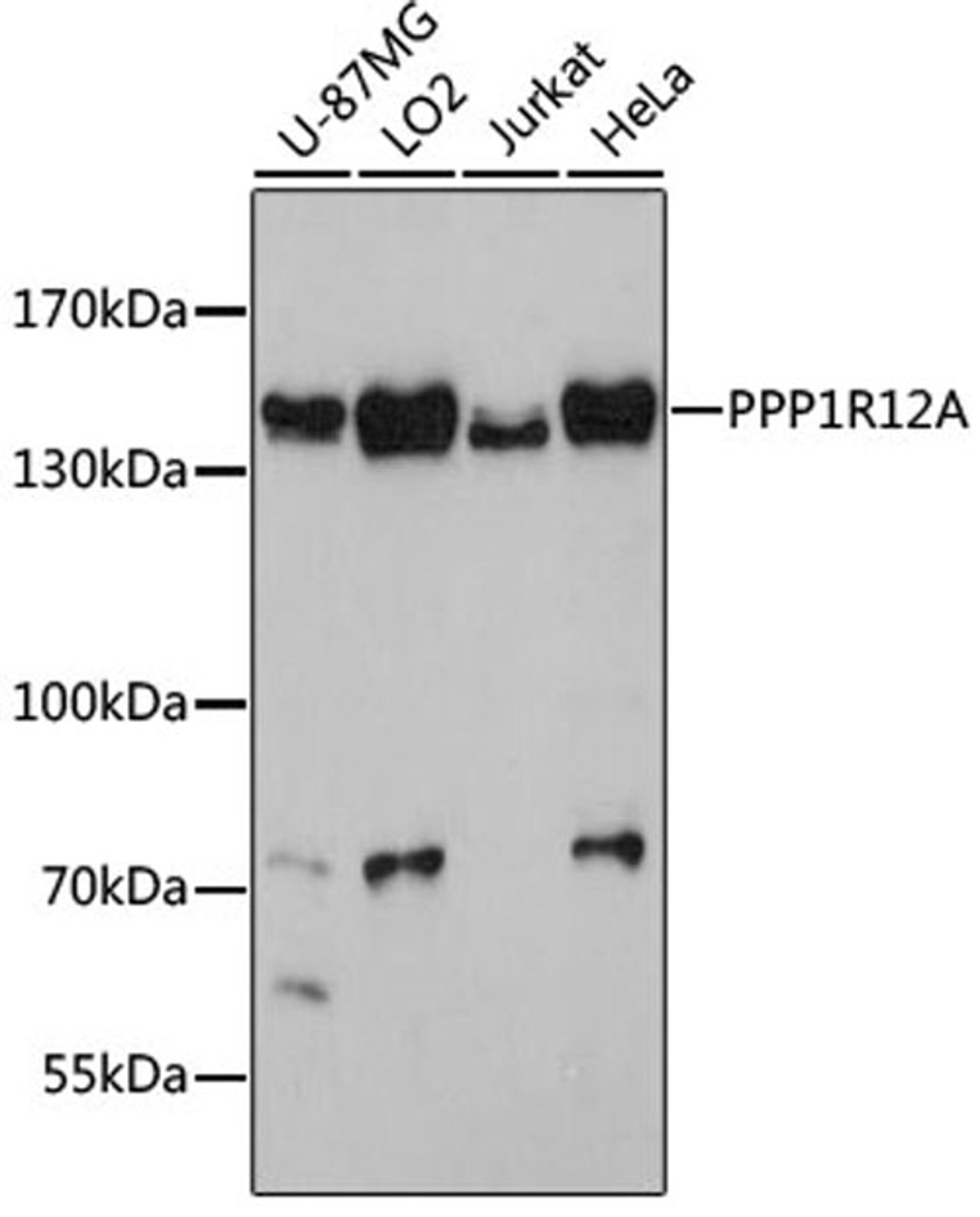 Western blot - PPP1R12A antibody (A0587)