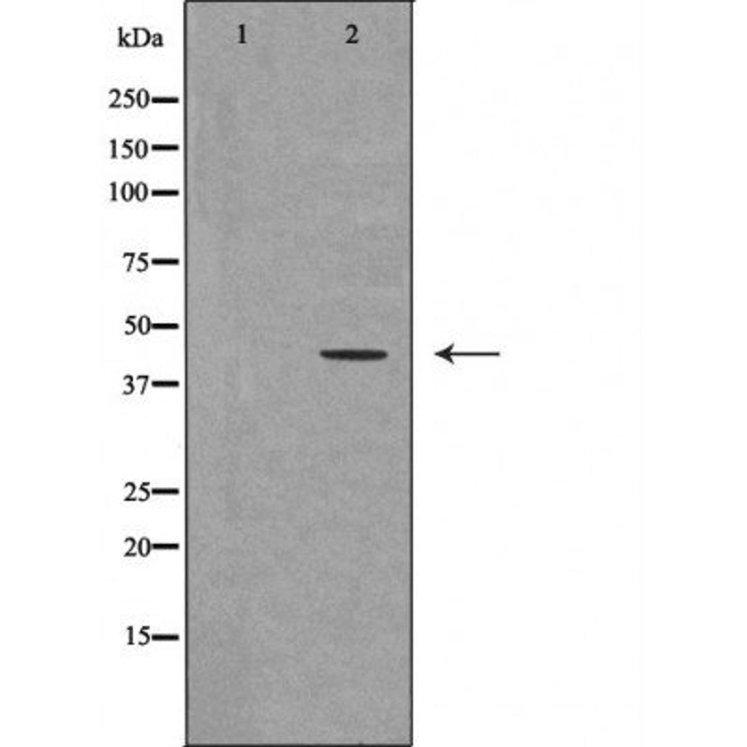 Western blot analysis of mouse fetalmuscle tissue lysate using UTS2R antibody