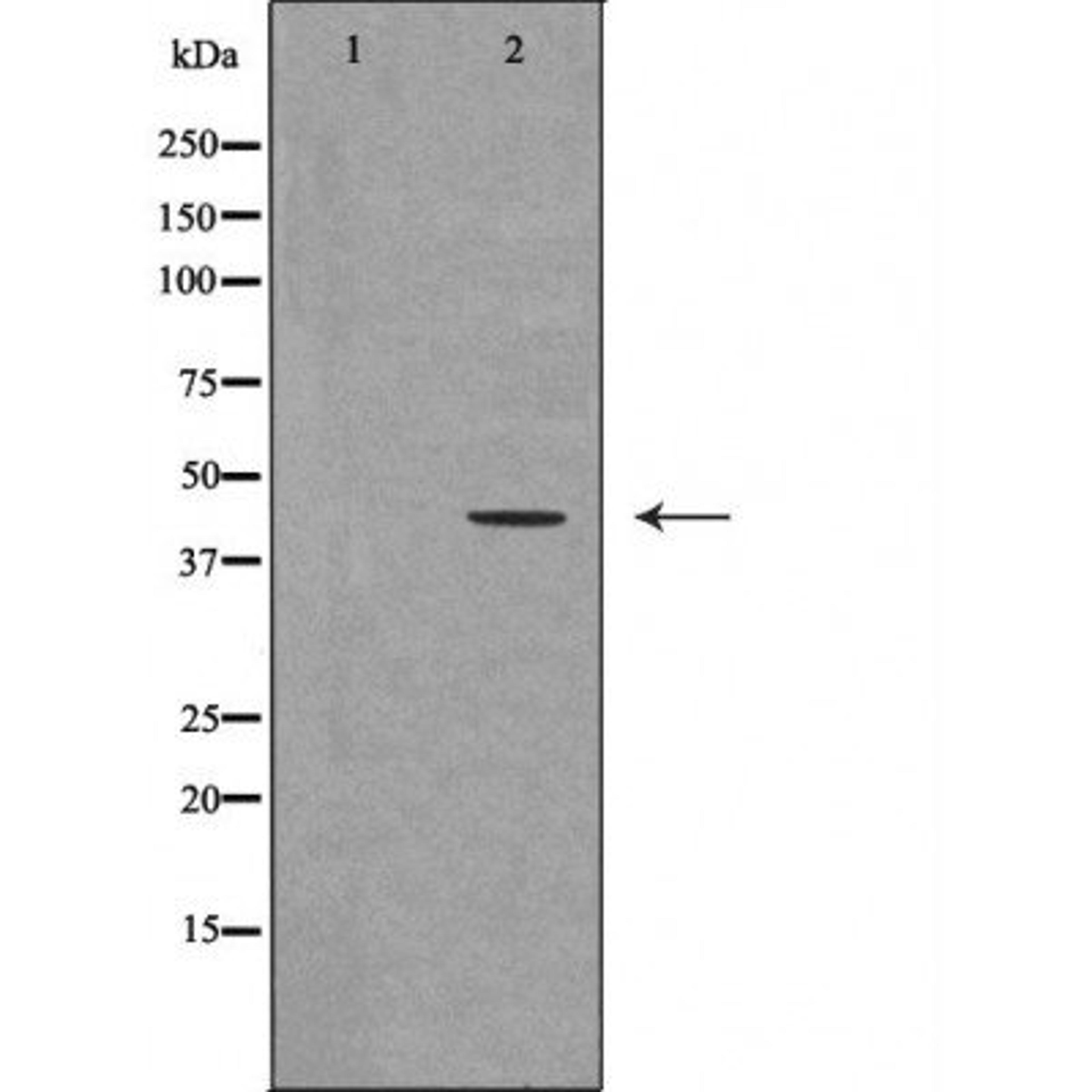 Western blot analysis of mouse fetalmuscle tissue lysate using UTS2R antibody