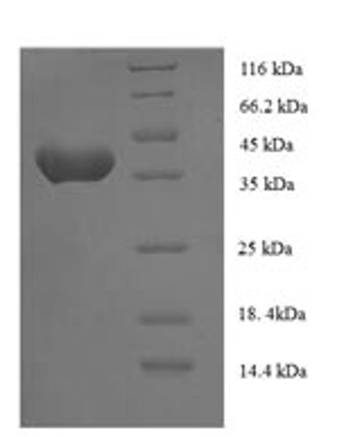 (Tris-Glycine gel) Discontinuous SDS-PAGE (reduced) with 5% enrichment gel and 15% separation gel.