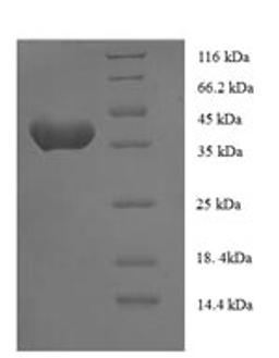 (Tris-Glycine gel) Discontinuous SDS-PAGE (reduced) with 5% enrichment gel and 15% separation gel.