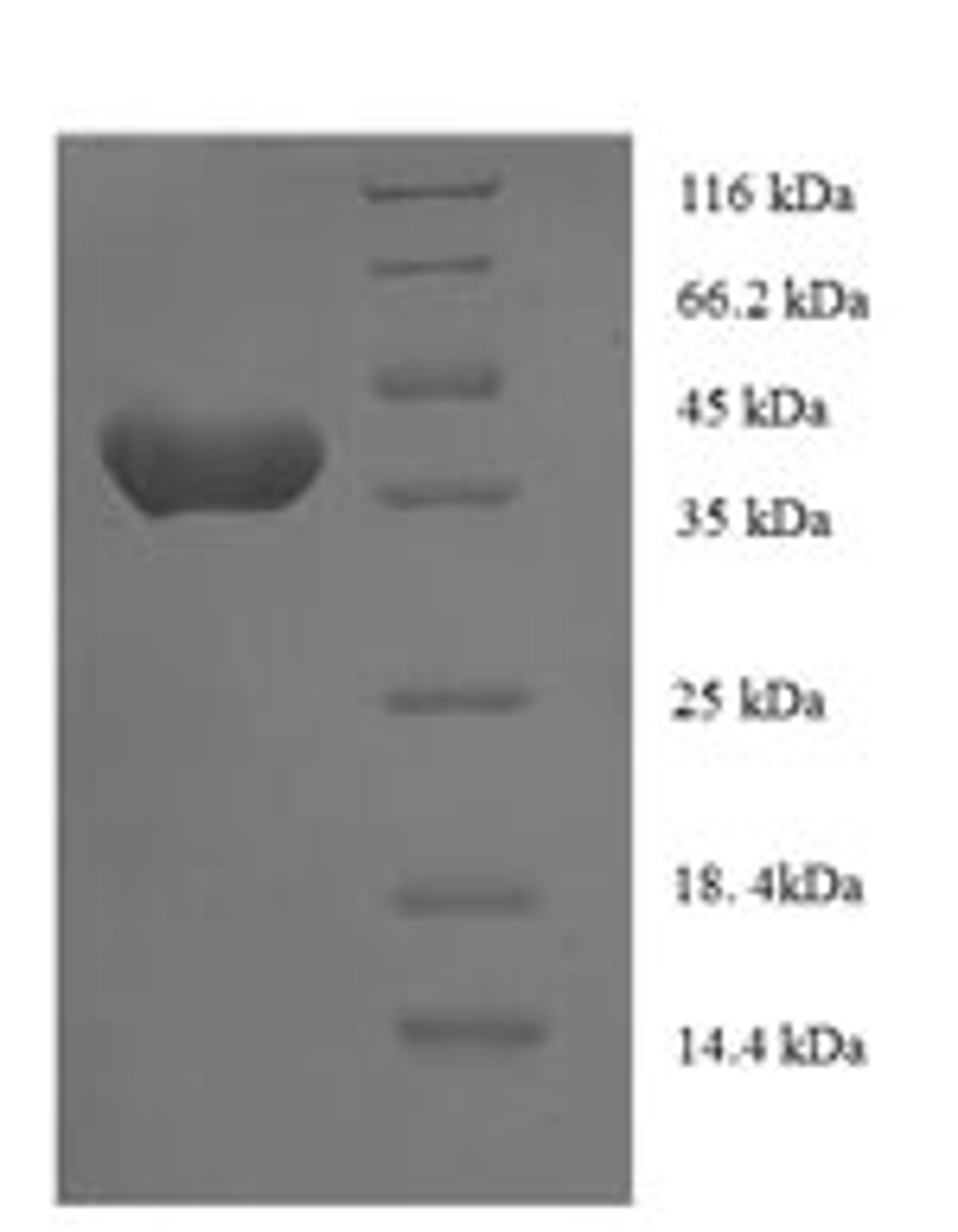 (Tris-Glycine gel) Discontinuous SDS-PAGE (reduced) with 5% enrichment gel and 15% separation gel.
