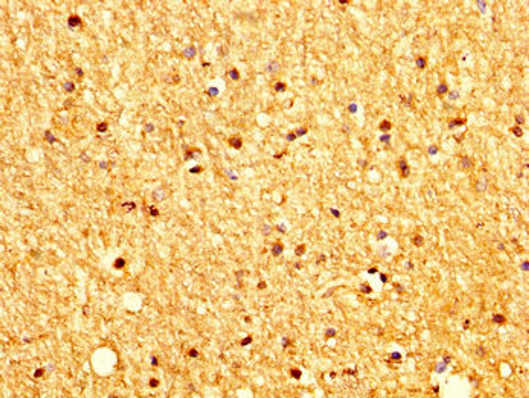 IHC image of CSB-PA896928LA01HU diluted at 1:200 and staining in paraffin-embedded human brain tissue performed on a Leica BondTM system. After dewaxing and hydration, antigen retrieval was mediated by high pressure in a citrate buffer (pH 6.0). Section was blocked with 10% normal goat serum 30min at RT. Then primary antibody (1% BSA) was incubated at 4&deg;C overnight. The primary is detected by a biotinylated secondary antibody and visualized using an HRP conjugated SP system.