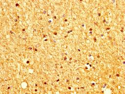 IHC image of CSB-PA896928LA01HU diluted at 1:200 and staining in paraffin-embedded human brain tissue performed on a Leica BondTM system. After dewaxing and hydration, antigen retrieval was mediated by high pressure in a citrate buffer (pH 6.0). Section was blocked with 10% normal goat serum 30min at RT. Then primary antibody (1% BSA) was incubated at 4&deg;C overnight. The primary is detected by a biotinylated secondary antibody and visualized using an HRP conjugated SP system.