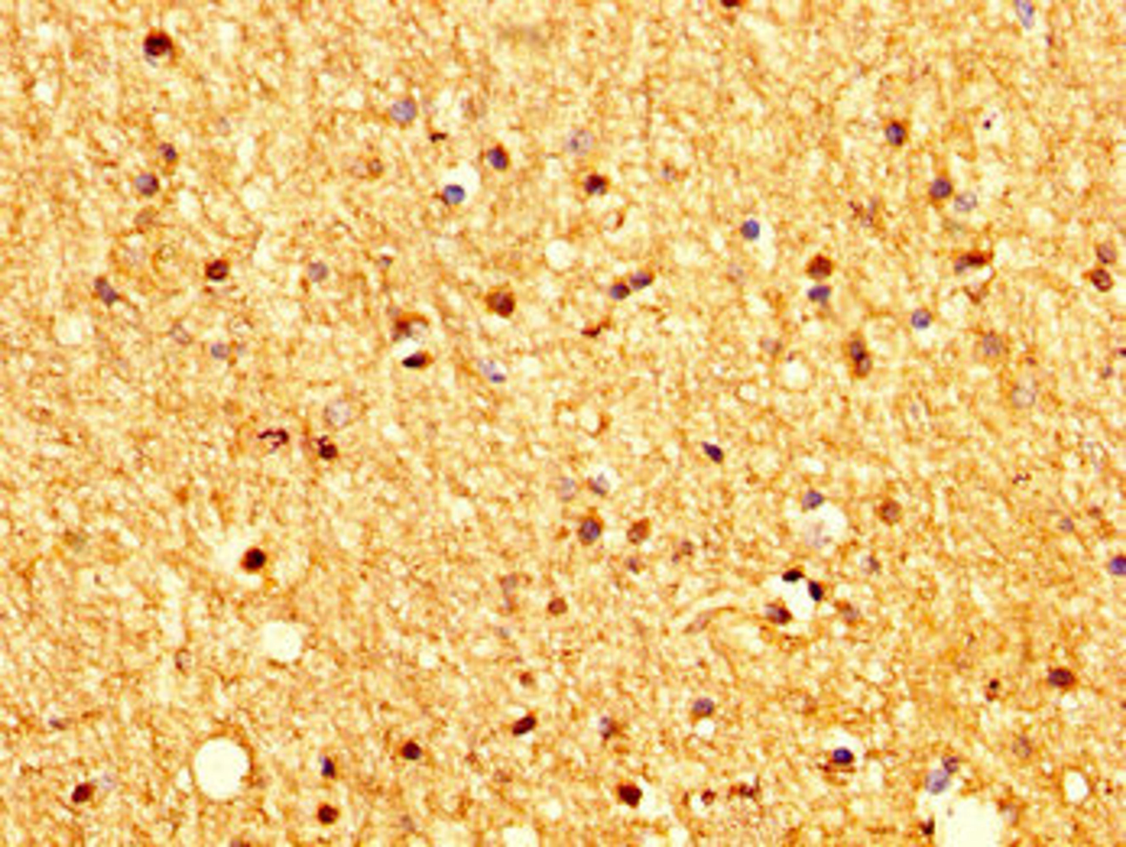 IHC image of CSB-PA896928LA01HU diluted at 1:200 and staining in paraffin-embedded human brain tissue performed on a Leica BondTM system. After dewaxing and hydration, antigen retrieval was mediated by high pressure in a citrate buffer (pH 6.0). Section was blocked with 10% normal goat serum 30min at RT. Then primary antibody (1% BSA) was incubated at 4&deg;C overnight. The primary is detected by a biotinylated secondary antibody and visualized using an HRP conjugated SP system.