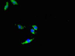 Immunofluorescent analysis of Hela cells using CSB-PA891717LA01HU at dilution of 1:100 and Alexa Fluor 488-congugated AffiniPure Goat Anti-Rabbit IgG(H+L)