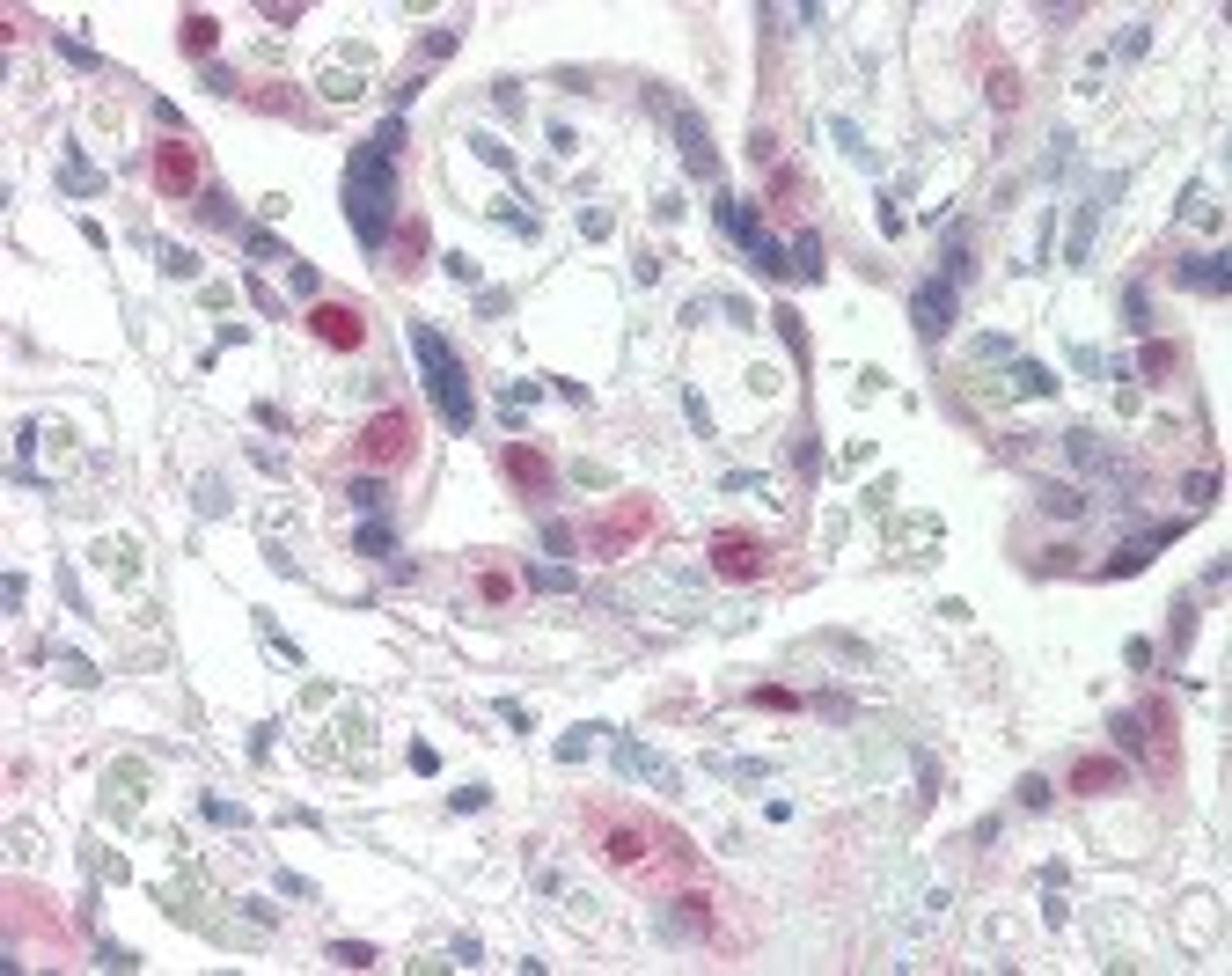 Immunohistochemistry staining of CDK2 in placenta tissue using CDK2 Monoclonal Antibody.