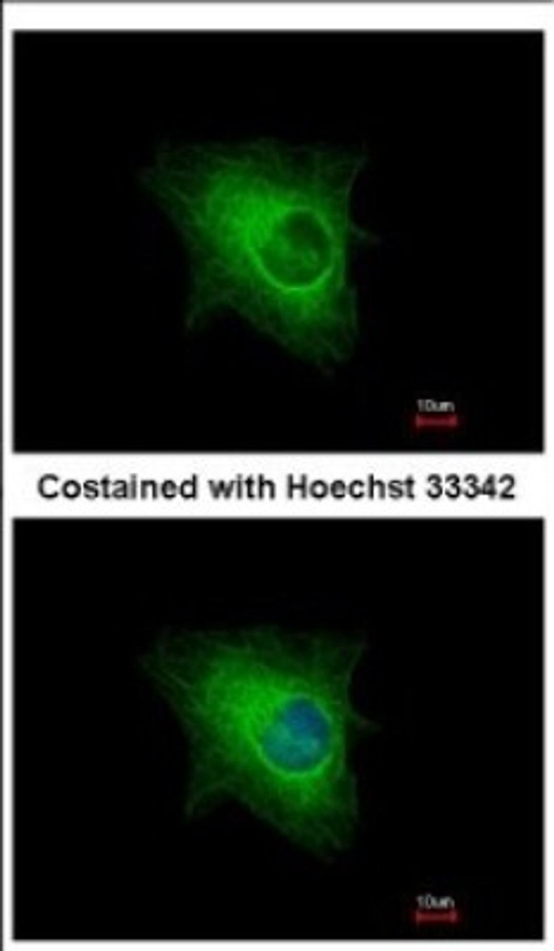 Immunocytochemistry/Immunofluorescence: KRTHA3B Antibody [NBP2-19310] - Immunofluorescence analysis of methanol-fixed HeLa, using antibody at 1:500 dilution.