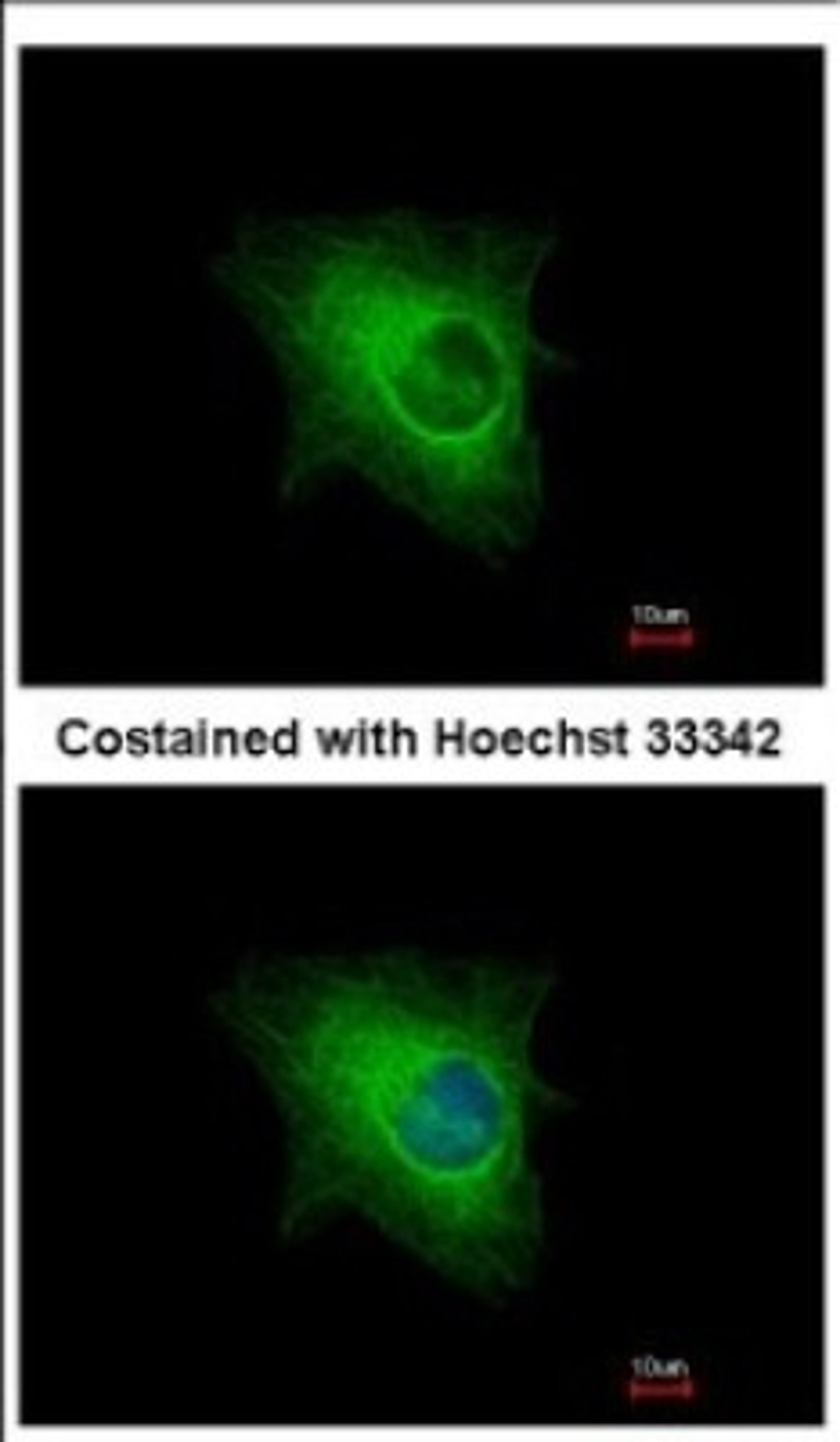 Immunocytochemistry/Immunofluorescence: KRTHA3B Antibody [NBP2-19310] - Immunofluorescence analysis of methanol-fixed HeLa, using antibody at 1:500 dilution.