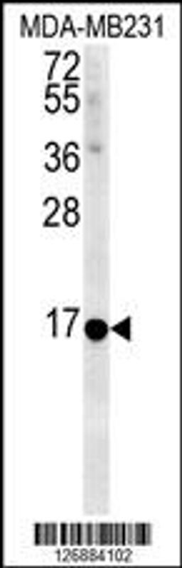 Western blot analysis in MDA-MB231 cell line lysates (35ug/lane).