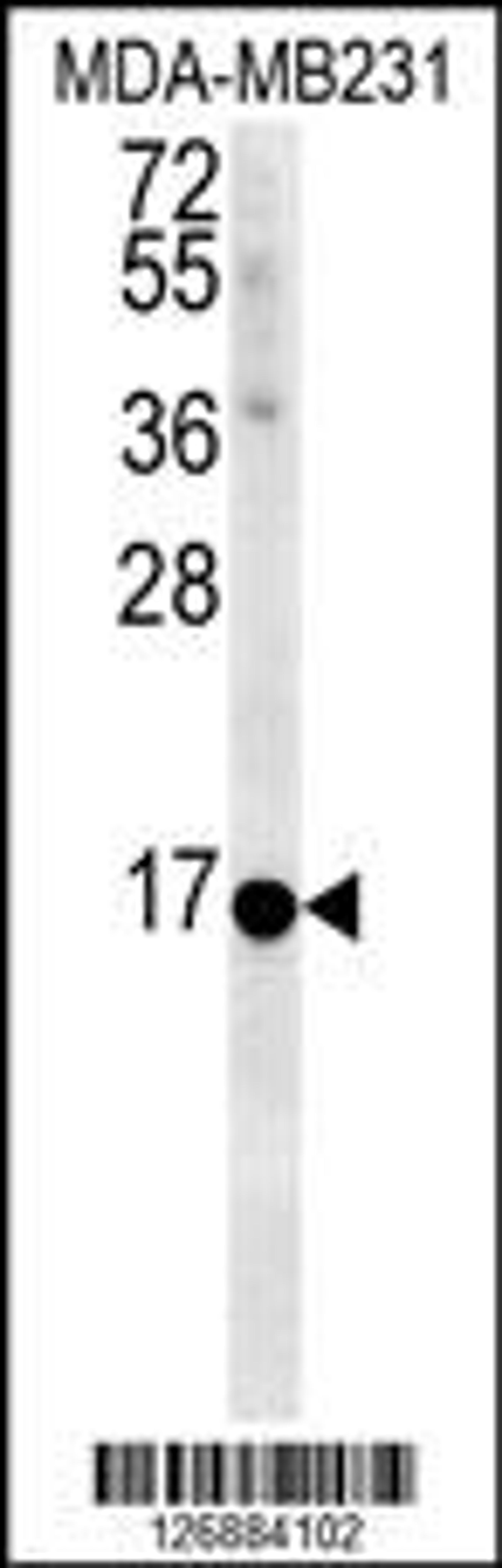 Western blot analysis in MDA-MB231 cell line lysates (35ug/lane).