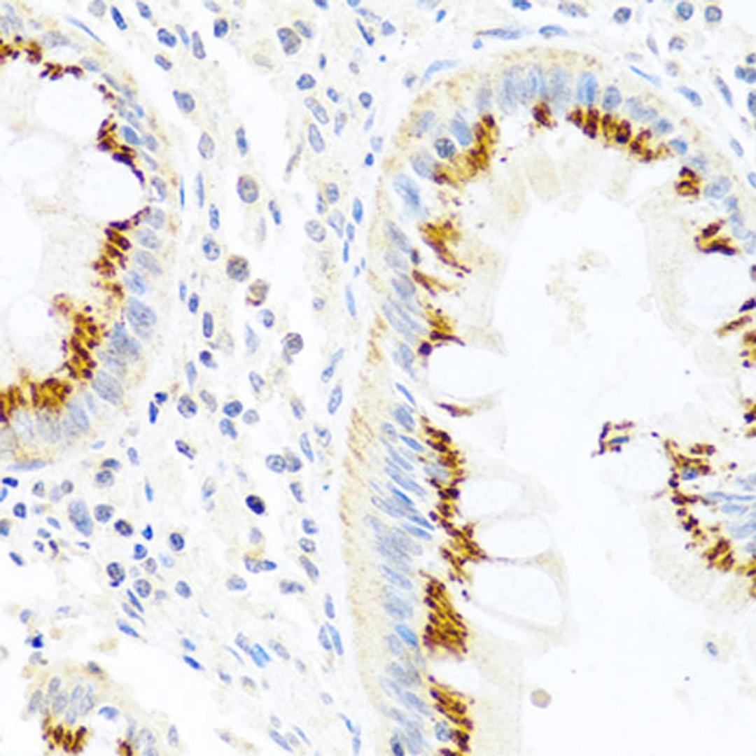 Immunohistochemistry - FAM3B antibody (A1082)