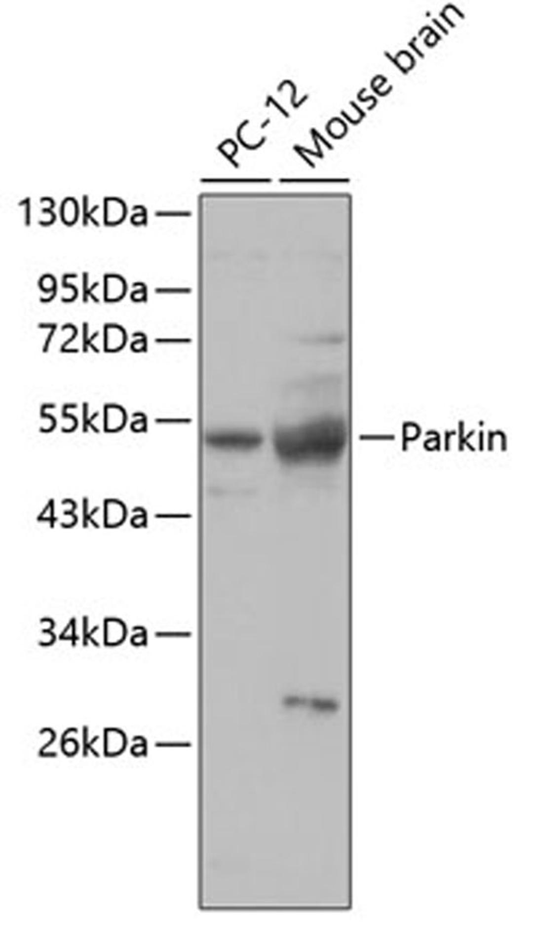 Western blot - Parkin antibody (A0968)