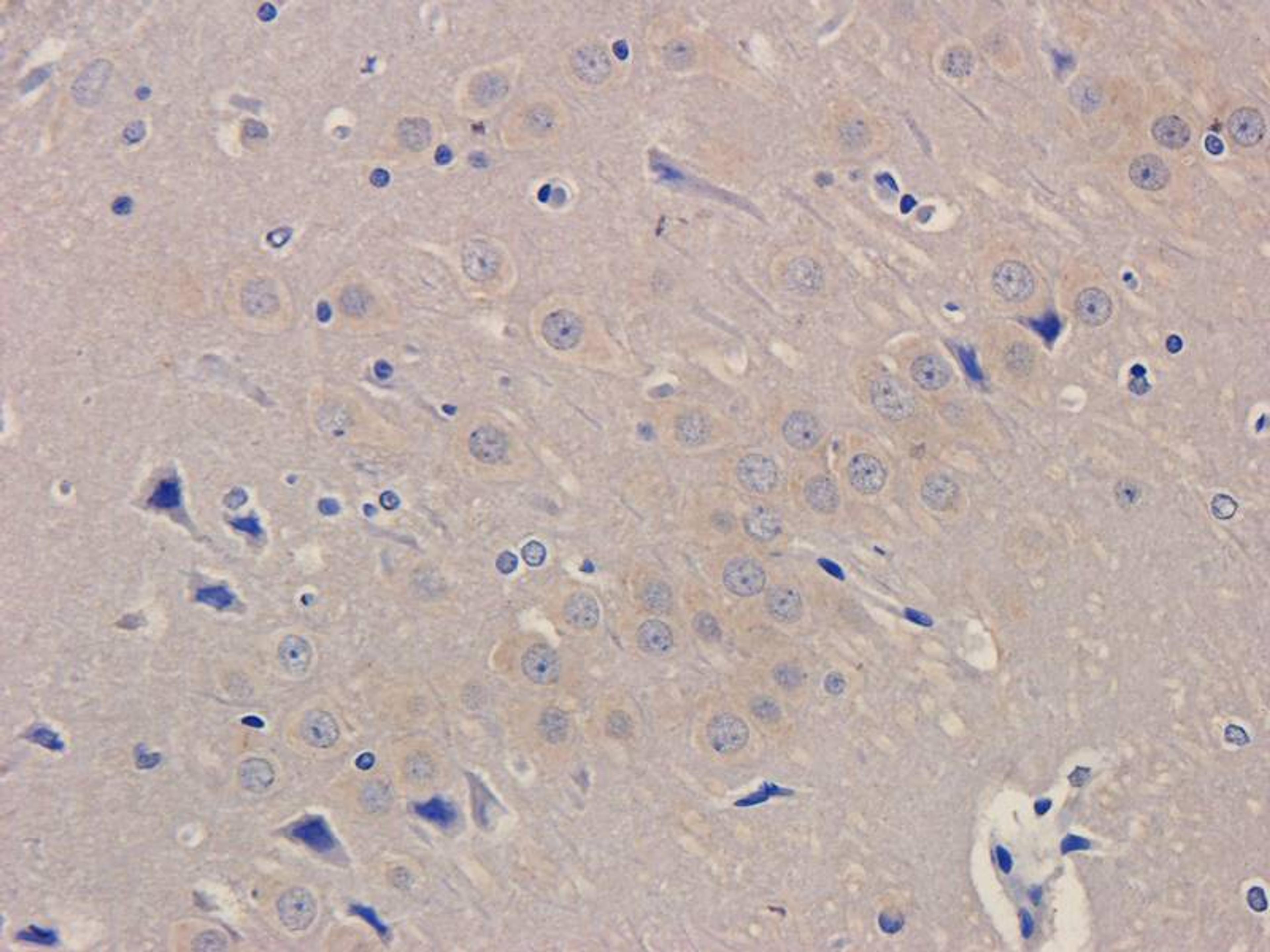 IHC-P staining of rat brain tissue using CD200 antibody (dilution at 2.5 ug/ml)