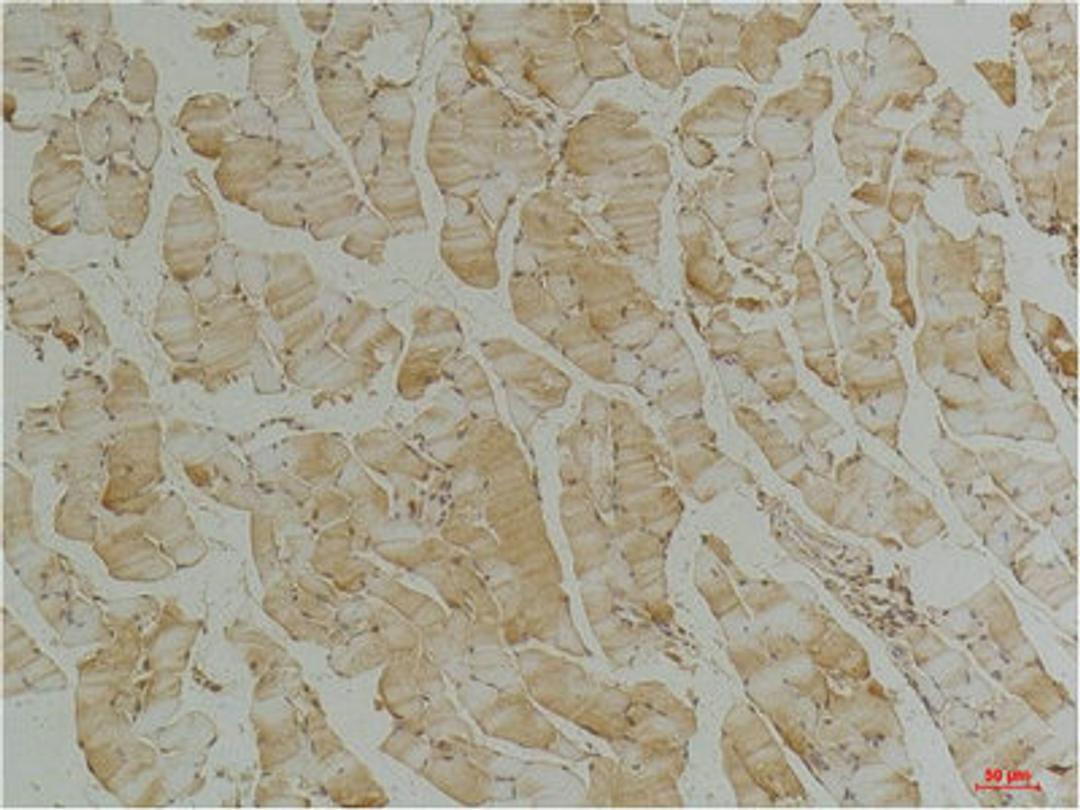 Immunohistochemical analysis of paraffin-embedded Mouse Skeletal Muscle Tissue using Desmin(mAb diluted at 1:200.