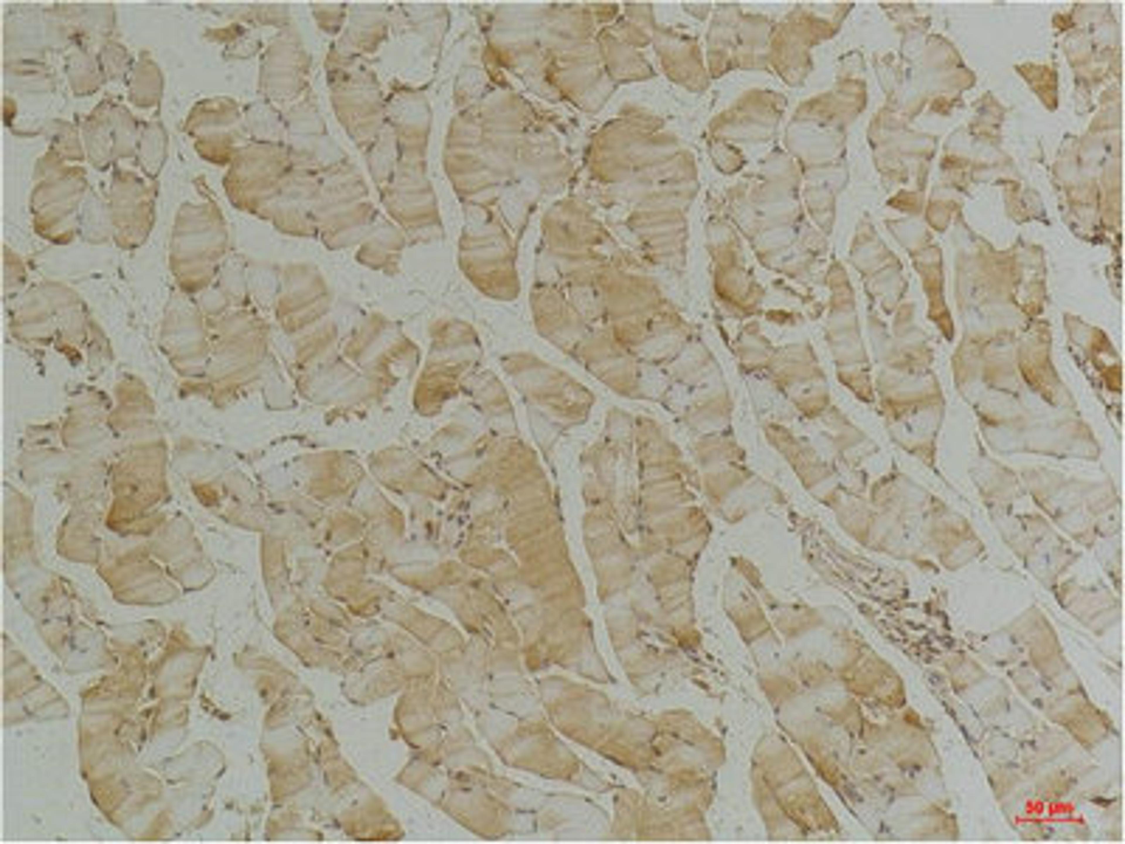 Immunohistochemical analysis of paraffin-embedded Mouse Skeletal Muscle Tissue using Desmin(mAb diluted at 1:200.