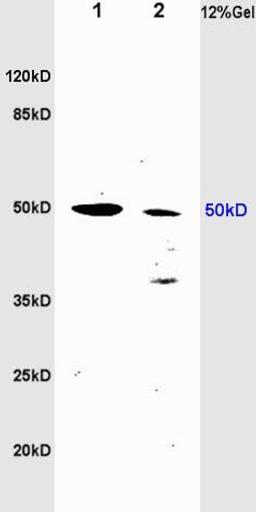 Western blot analysis of rat brain lysates(Lane 1), rat heart lysates (Lane2) using tubulin Beta antibody