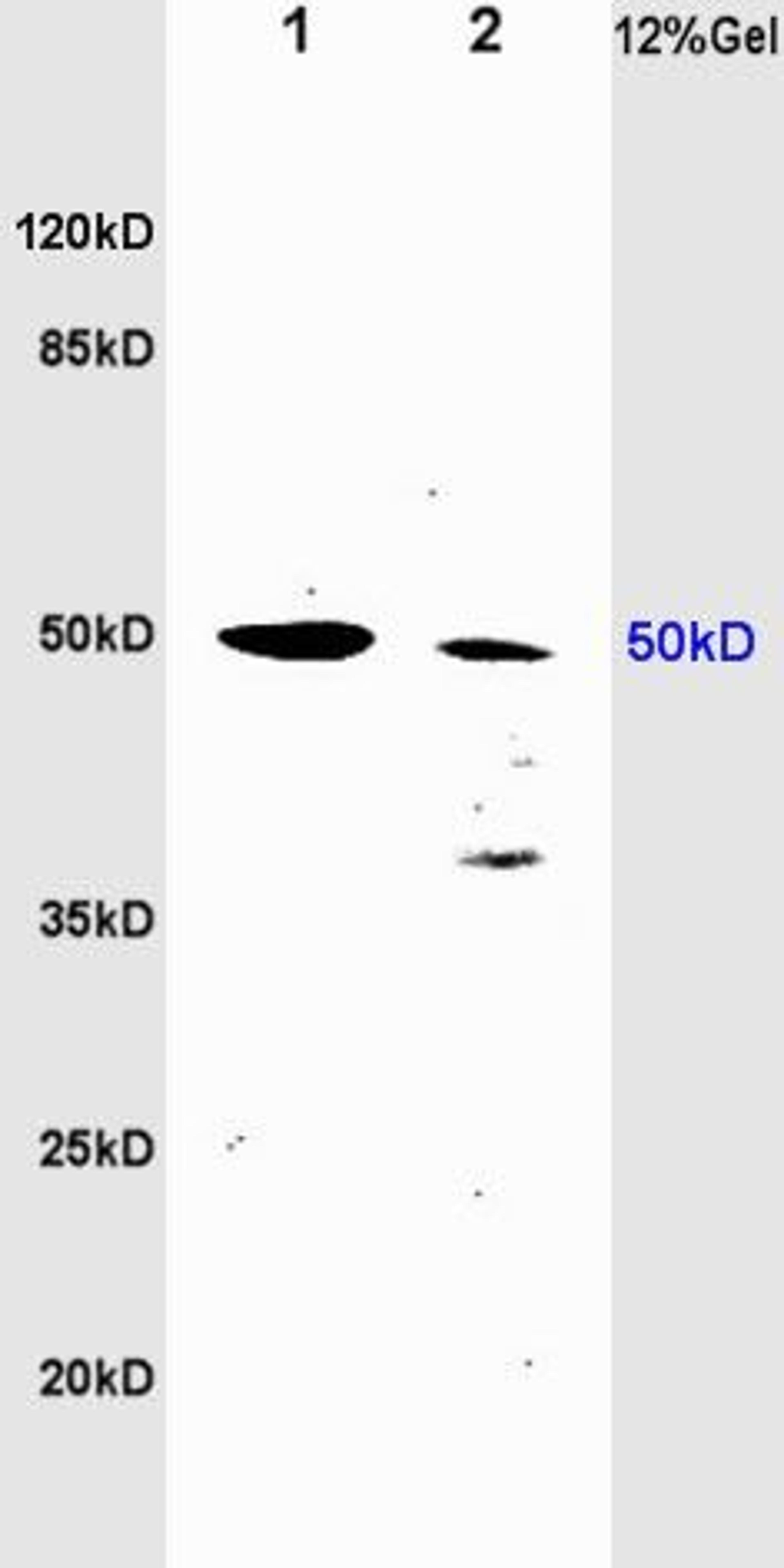 Western blot analysis of rat brain lysates(Lane 1), rat heart lysates (Lane2) using tubulin Beta antibody