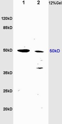 Western blot analysis of rat brain lysates(Lane 1), rat heart lysates (Lane2) using tubulin Beta antibody