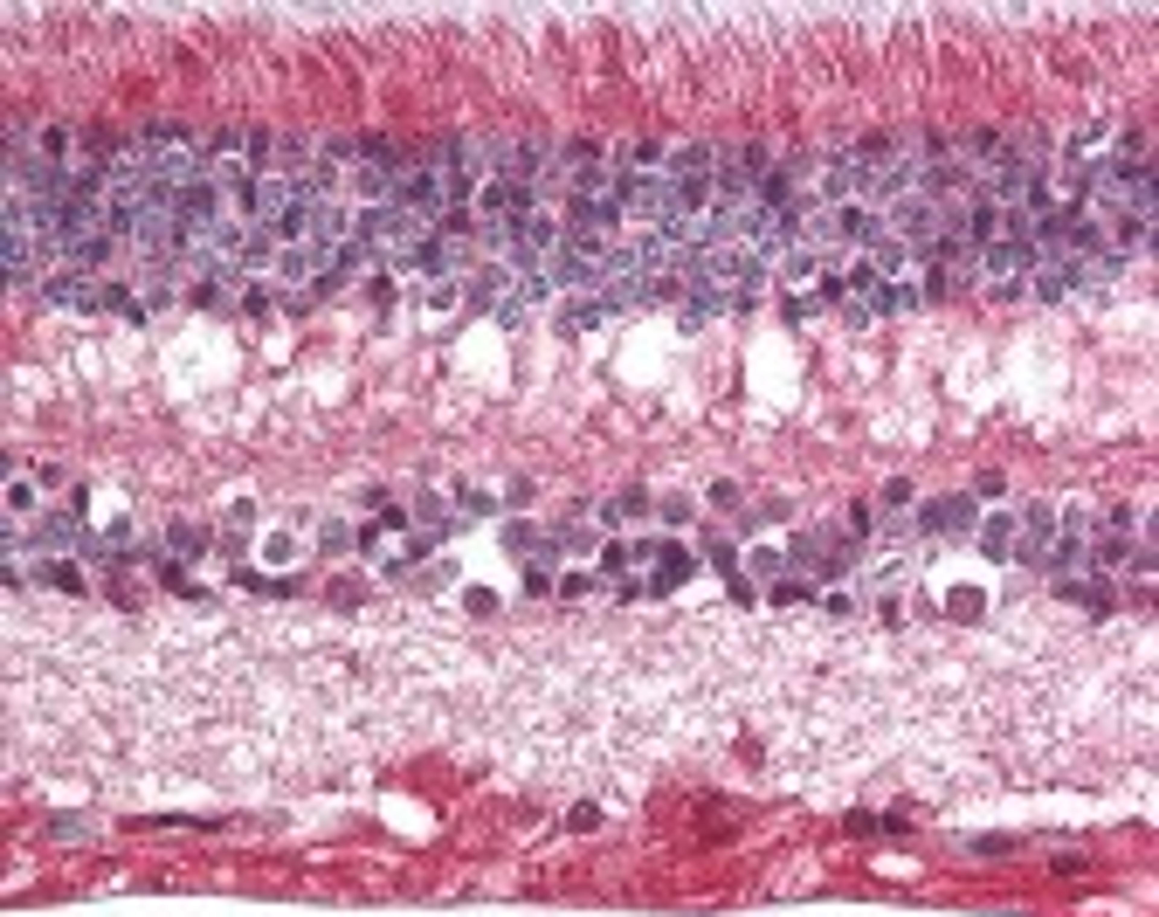 Immunohistochemistry staining of Myocilin in eye, retina tissue using Myocilin Antibody.