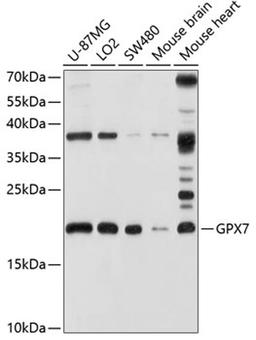 Western blot - GPX7 antibody (A3902)